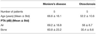 Distinct MicroRNA Profiles in the Perilymph and Serum of Patients With Menière's Disease